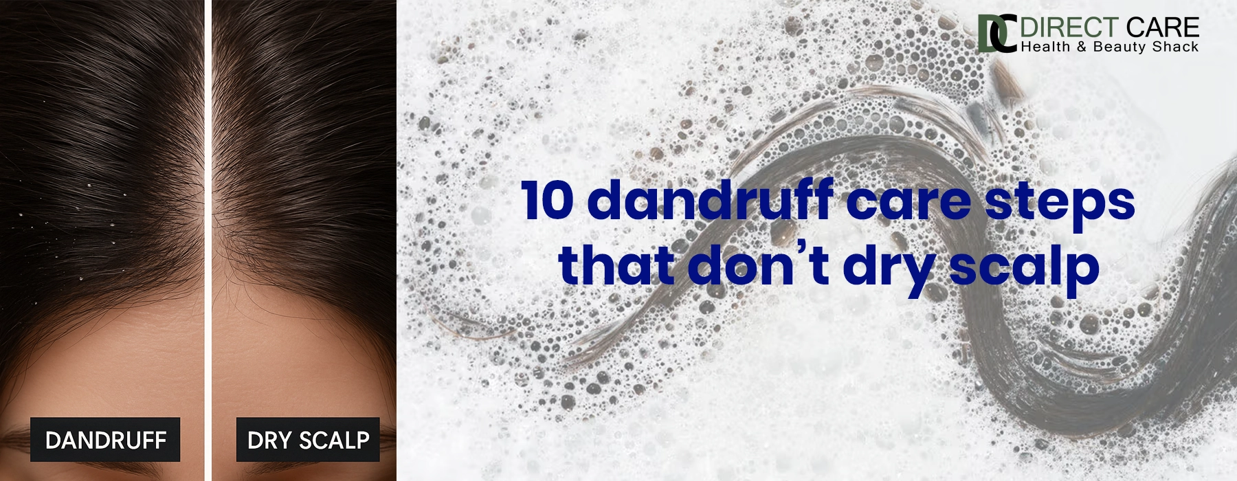 10 Dandruff Care Steps That Don’t Dry Scalp Personal Care article
