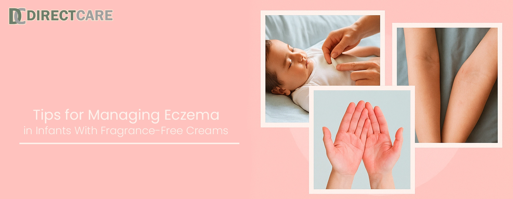 Tips for Managing Eczema in Infants With Fragrance-Free Creams Health Care article